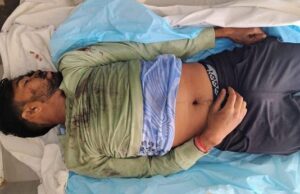 कुसमुंडा खदान हादसा: सिलेंडर फटने से ऑपरेटर की मौत, दो मजदूर घायल…