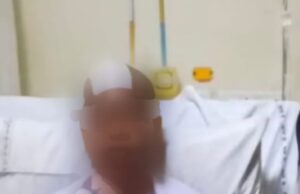 ब्रेन ट्यूमर का सफल ऑपरेशन, 7 घंटे की सर्जरी से महिला को मिला नया जीवन