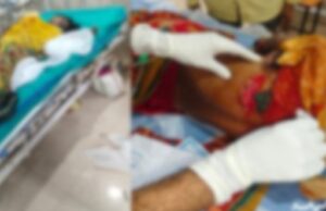 तेंदूपत्ता तोड़ने गई महिलाओं पर जंगली सूअर ने किया हमला, 5 की हालत गंभीर, इलाज जारी