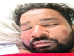 कोरबा में आधी रात का खूनी बवाल: एएसआई का बेटा गंभीर, युवक का अपहरण कर बेरहमी से की पिटाई, लूटपाट का भी आरोप