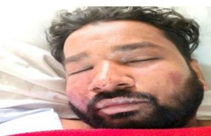 कोरबा में आधी रात का खूनी बवाल: एएसआई का बेटा गंभीर, युवक का अपहरण कर बेरहमी से की पिटाई, लूटपाट का भी आरोप