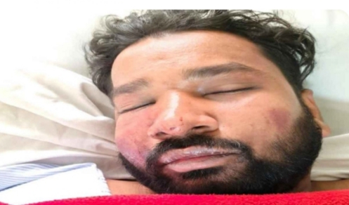 कोरबा में आधी रात का खूनी बवाल: एएसआई का बेटा गंभीर, युवक का अपहरण कर बेरहमी से की पिटाई, लूटपाट का भी आरोप